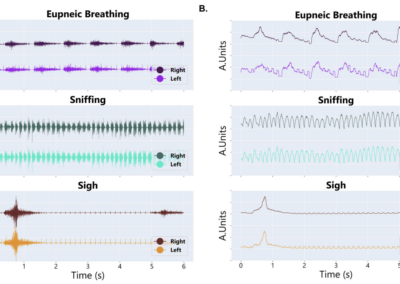 Implant for Reliable Diaphragm EMG Recordings in Awake, Behaving Rats